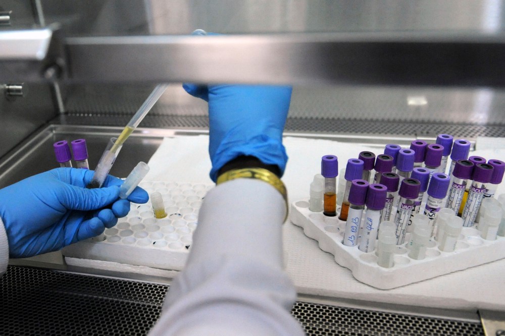 A laboratory technician at the AIDS Research Center of the Treichville hospital in Abidjan works on blood samples of people living with HIV on Sept. 13, 2013. (Photo by Sia Kambou/AFP/Getty)