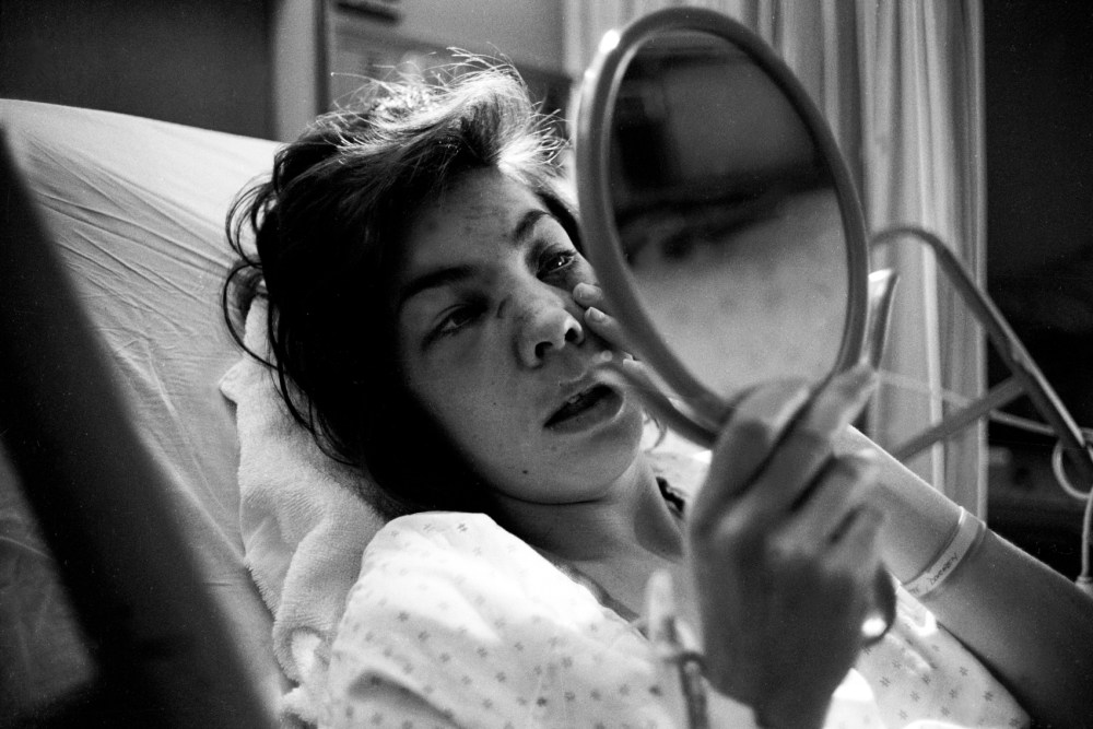 Diane, who was beaten by her spouse, looks in the mirror at a hospital.