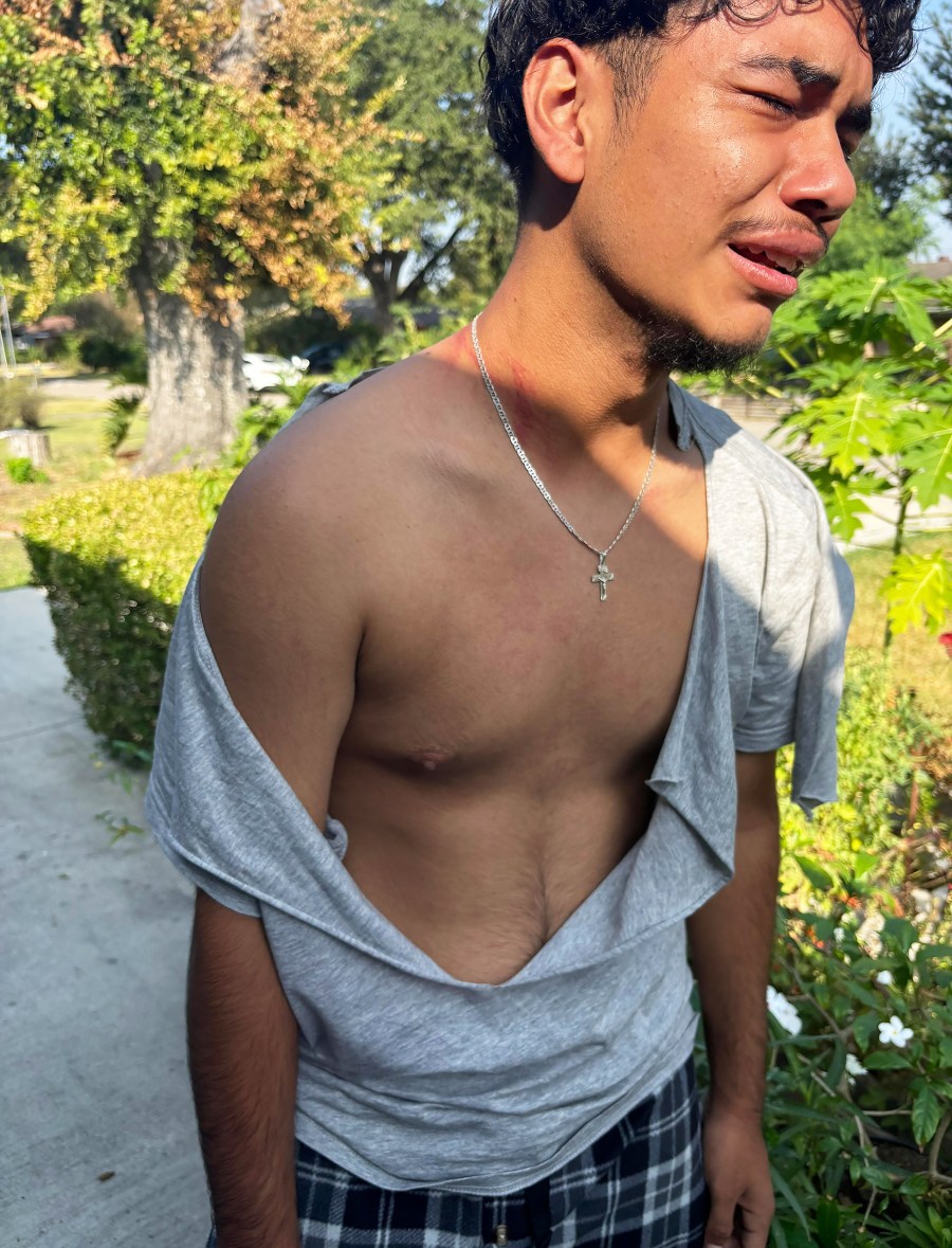 Arnoldo Bazán returned to his home with bruises, scratches, and his shirt torn open after agents tackled the 16-year-old and placed him in a head hold.